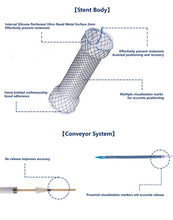 Cargar imagen en el visor de la galería, Stent esofágico autoexpansible