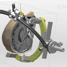 Cargar imagen en el visor de la galería, Neurocirugía funcional iPS
